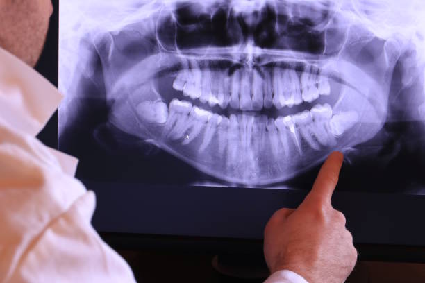 Best Emergency Denture Repair in Rantoul, IL