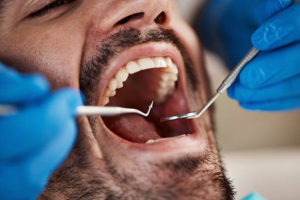Best Emergency Treatment for Dental Infections or Abscesses in Rantoul, IL